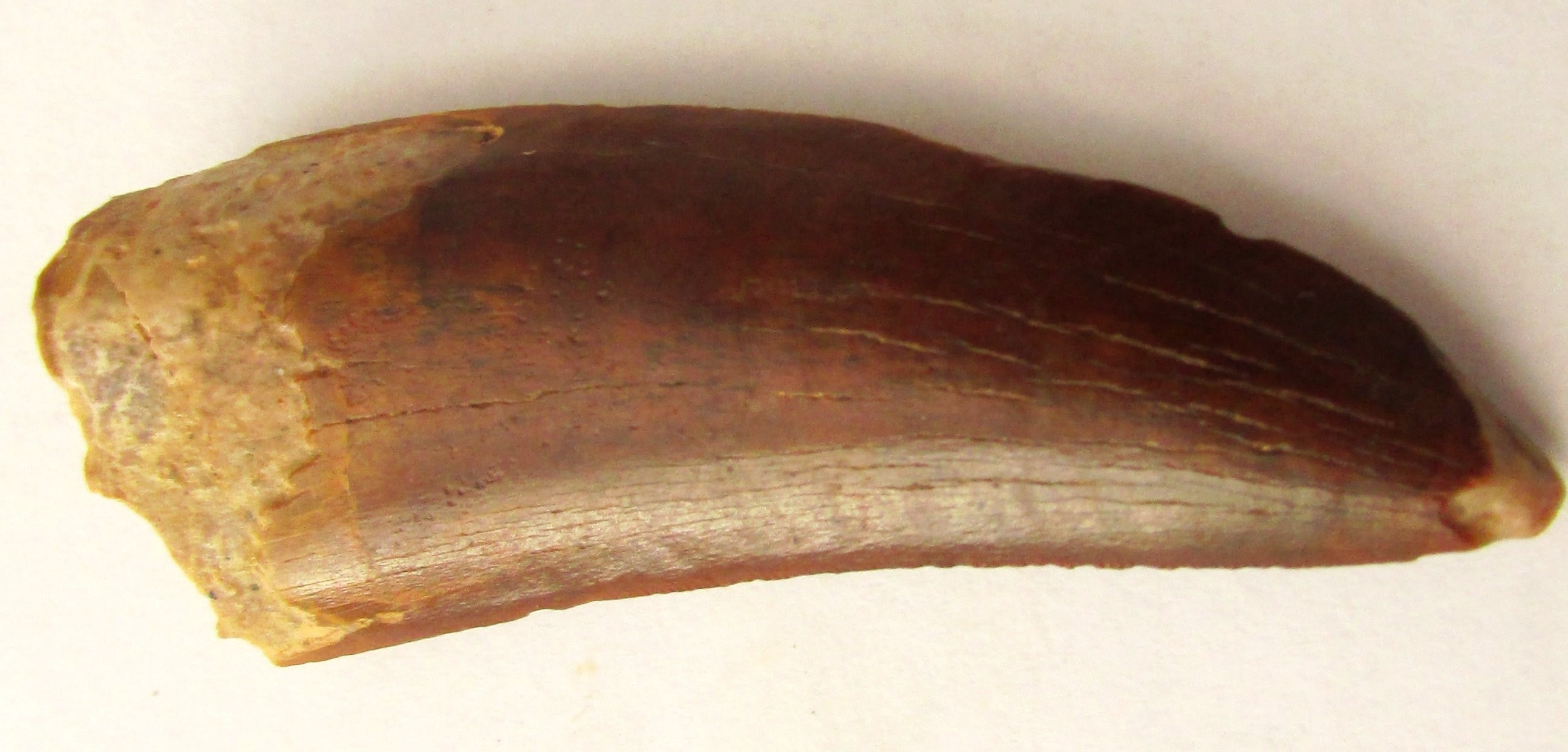 tooth01