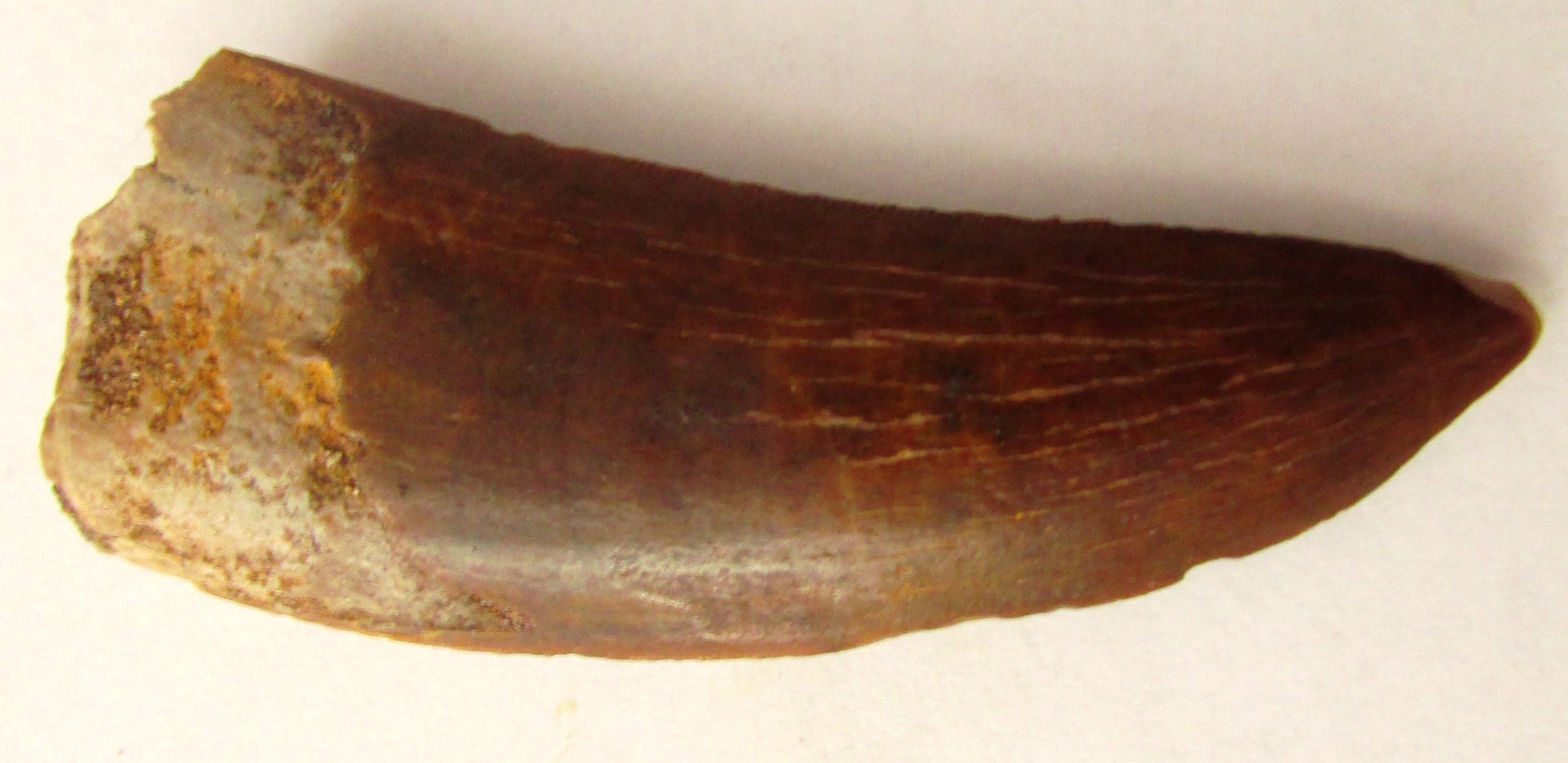 tooth01
